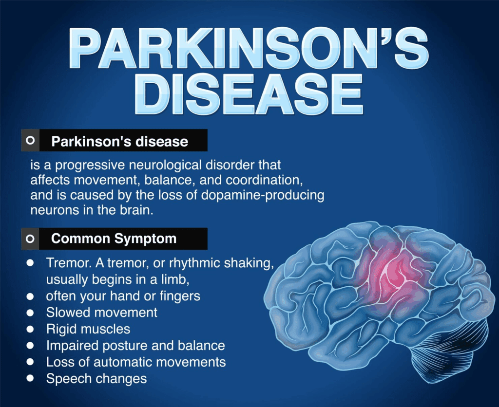 Parkinson’s disease Chart.