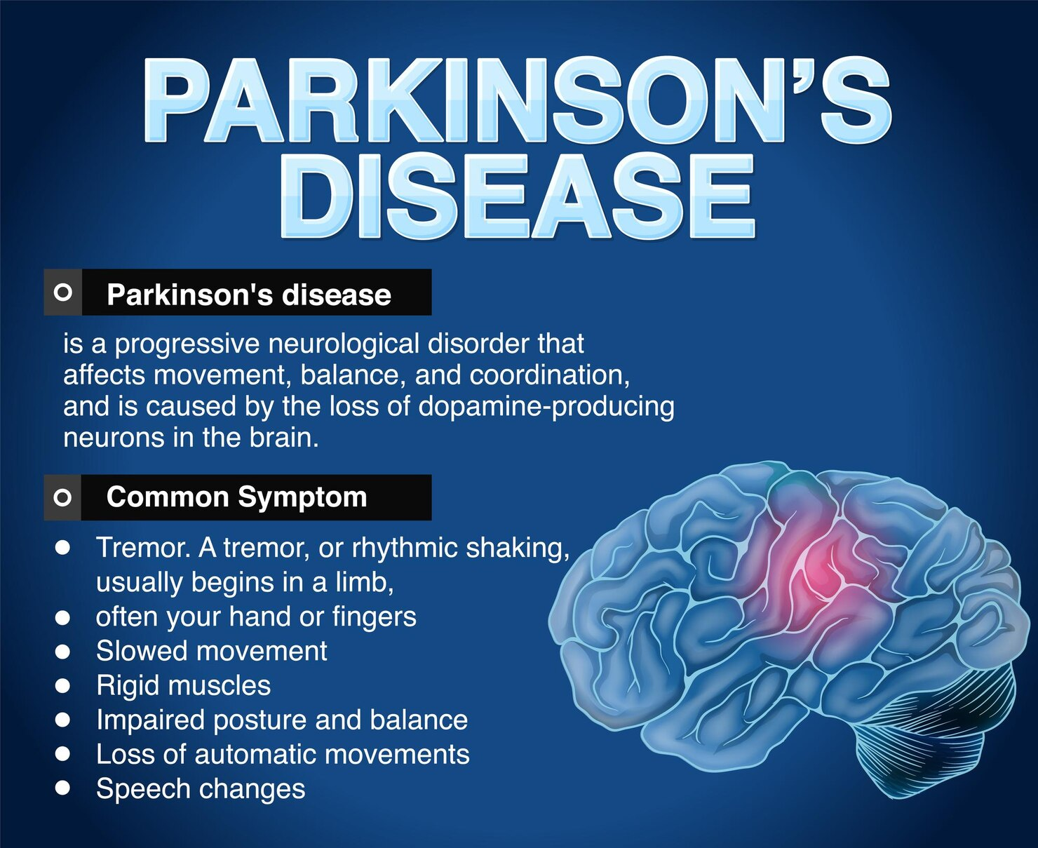 Parkinson’s disease Chart.