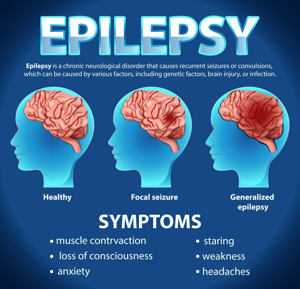 epilepsy symptoms Neurological Disorder